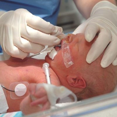 Neonatal image